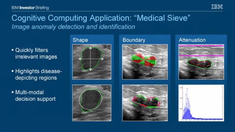 IBM Medical Sieve